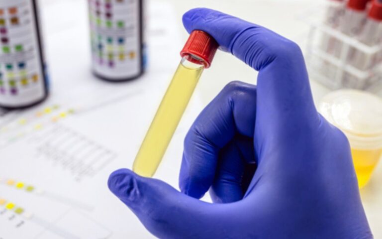 Brasil tem mais de 1,1 milhão de motoristas com exame toxicológico vencido